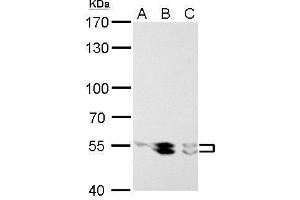 WB Image LYN antibody detects LYN protein by Western blot analysis.