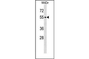 Western blot analysis of NUP50 Antibody (Center) in WiDr cell line lysates (35ug/lane). (NUP50 Antikörper  (Middle Region))