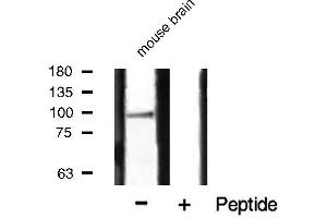 Western blot analysis of HSP90B phosphorylation expression in mouse brain tissue lysates,The lane on the right is treated with the antigen-specific peptide. (HSP90AB1 Antikörper  (pSer254))