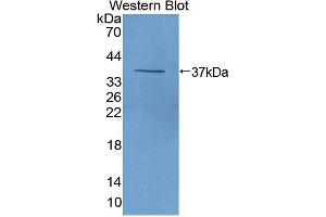 Western blot analysis of the recombinant protein. (beta-Thromboglobulin Antikörper  (AA 46-107))