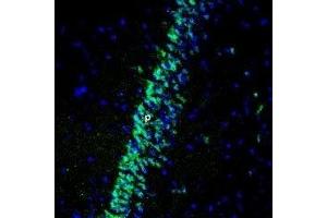 Expression of Gastric inhibitory polypeptide receptor in rat hippocampus - Immunohistochemical staining of perfusion-fixed frozen rat brain sections using Anti-GIPR (extracellular) Antibody (ABIN7043209, ABIN7044412 and ABIN7044413), (1:400), followed by anti-rabbit-Alexa-488 antibody. (GIPR Antikörper  (Extracellular))