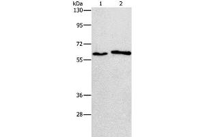 Western Blot analysis of A172 and A549 cell using CHRNA2 Polyclonal Antibody at dilution of 1:950 (CHRNA2 Antikörper)