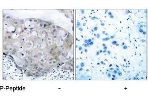 Image no. 1 for anti-VEGF Receptor 2 (VEGFR2) (pTyr951) antibody (ABIN196770) (VEGFR2/CD309 Antikörper  (pTyr951))