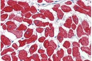 Human Heart (formalin-fixed, paraffin-embedded) stained with TNNI3 antibody ABIN462345 followed by biotinylated anti-goat IgG secondary antibody ABIN481715, alkaline phosphatase-streptavidin and chromogen. (TNNI3 Antikörper  (AA 27-40))