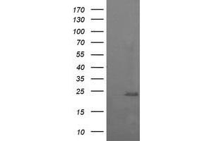 Image no. 2 for anti-RAB37, Member RAS Oncogene Family (RAB37) antibody (ABIN1500561) (RAB37 Antikörper)