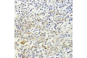 Immunohistochemistry of paraffin-embedded human tonsil using LDB1 antibody (ABIN7268255) at dilution of 1:200 (40x lens). (LIM Domain Binding 1 Protein Antikörper  (AA 1-50))
