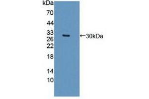 Western blot analysis of recombinant Human DCLK1. (DCLK1 Antikörper  (AA 390-647))