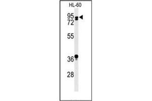Western blot analysis of PATL1 Antibody (C-term) in HL-60 cell line lysates (35ug/lane). (PATL1 Antikörper  (C-Term))