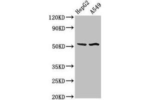 Western Blot Positive WB detected in: HepG2 whole cell lysate, A549 whole cell lysate All lanes: SPRED1 antibody at 3 μg/mL Secondary Goat polyclonal to rabbit IgG at 1/50000 dilution Predicted band size: 51 kDa Observed band size: 51 kDa (SPRED1 Antikörper  (AA 123-311))