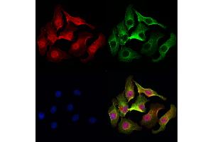 ABIN6256971 and ABIN6275153 staining Hela cells by IF/ICC.