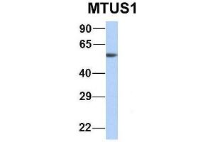 Western Blotting (WB) image for anti-Microtubule Associated Tumor Suppressor 1 (MTUS1) (Middle Region) antibody (ABIN2781855)