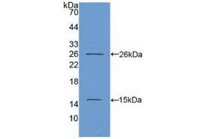 Detection of Recombinant Ki67P, Human using Polyclonal Antibody to Ki-67 Protein (Ki-67) (Ki-67 Antikörper  (AA 2815-2928))