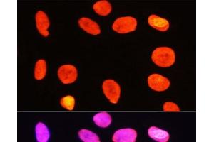 Immunofluorescence analysis of C6 cells using Symmetric DiMethyl-Histone H3-R2 Polyclonal Antibody at dilution of 1:100 (40x lens).