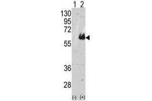 Image no. 1 for anti-Microtubule-Associated Protein tau (MAPT) (C-Term) antibody (ABIN357423) (MAPT Antikörper  (C-Term))