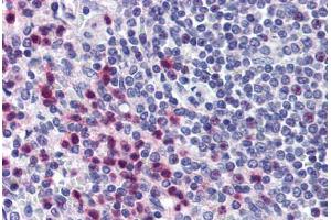 Human Spleen (formalin-fixed, paraffin-embedded) stained with STRAP antibody ABIN290242 at 10 ug/ml followed by biotinylated goat anti-rabbit IgG secondary antibody ABIN481713, alkaline phosphatase-streptavidin and chromogen. (STRAP Antikörper  (AA 230-280))