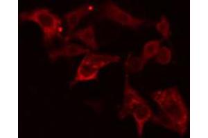 ABIN6274640 staining HepG2 cells by IF/ICC. (CYP26A1 Antikörper  (Internal Region))