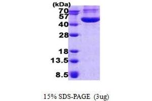 Chitinase 3-Like 1 (Cartilage Glycoprotein-39) (CHI3L1) (AA 22-383) protein (His-Myc tag)
