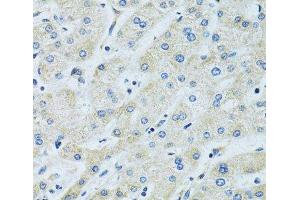 Immunohistochemistry of paraffin-embedded Human liver using SLC5A6 Polyclonal Antibody at dilution of 1:100 (40x lens). (SLC5A6 Antikörper)