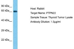 Host: Rabbit Target Name: PTPN22 Sample Type: Thyroid Tumor lysates Antibody Dilution: 1. (PTPN22 Antikörper  (Middle Region))