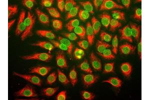Human HeLa cells were stained with monoclonal antibody ABIN1842239, which binds to a nuclear pore complex antigen, and chicken antibody to vimentin CPCA-Vim.