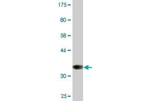 Western Blot detection against Immunogen (36. (Recoverin Antikörper  (AA 101-199))