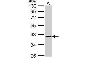 WB Image Sample (30 ug of whole cell lysate) A: A431 , 10% SDS PAGE antibody diluted at 1:1000 (TALDO1 Antikörper  (N-Term))