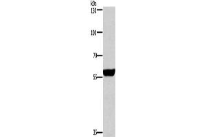 Gel: 6 % SDS-PAGE, Lysate: 40 μg, Lane: Mouse brain tissue, Primary antibody: ABIN7130690(PPP3CA Antibody) at dilution 1/650, Secondary antibody: Goat anti rabbit IgG at 1/8000 dilution, Exposure time: 1 second (PPP3CA Antikörper)