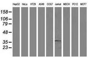 Image no. 3 for anti-Aminoacylase 3 (ACY3) antibody (ABIN1496463) (Aminoacylase 3 Antikörper)