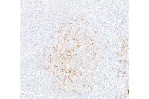 Immunohistochemistry (IHC) image for anti-Programmed Cell Death 1 Ligand 2 (PDCD1LG2) (AA 20-220) antibody (ABIN7795676)