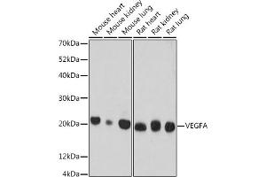 Western Blotting (WB) image for anti-Vascular Endothelial Growth Factor A (VEGFA) antibody (ABIN7271295)