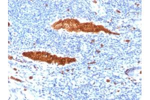Formalin-fixed, paraffin-embedded human Tonsil stained with Glycophorin A Mouse Monoclonal Antibody (JC159). (CD235a/GYPA Antikörper)