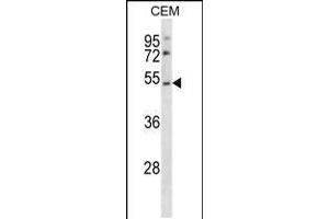 Western blot analysis in CEM cell line lysates (35ug/lane). (P2RY2 Antikörper  (C-Term))
