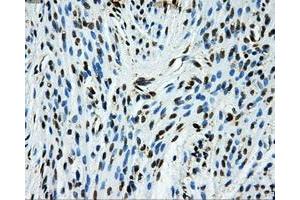Immunohistochemical staining of paraffin-embedded Ovary tissue using anti-GRIPAP1mouse monoclonal antibody. (GRIPAP1 Antikörper)