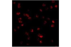 Immunofluorescence of TLR8 in Daudi cells with TLR8 antibody at 10 µg/ml. (TLR8 Antikörper  (Middle Region))