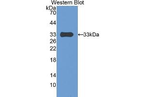 Western blot analysis of the recombinant protein. (PAPPA Antikörper  (AA 1270-1558))