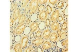 Immunohistochemistry of paraffin-embedded human kidney tissue using ABIN7154376 at dilution of 1:100 (GRHL2 Antikörper  (AA 1-265))