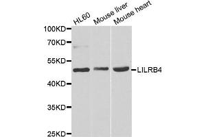 Western blot analysis of extracts of various cell lines, using LILRB4 antibody. (LILRB4 Antikörper)