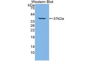 Western blot analysis of the recombinant protein. (IRF6 Antikörper  (AA 150-445))