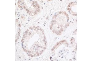 anti-AT Rich Interactive Domain 2 (ARID, RFX-Like) (ARID2) (AA 1785-1835) antibody