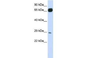 WB Suggested Anti-PRTFDC1 Antibody Titration:  0. (PRTFDC1 Antikörper  (N-Term))