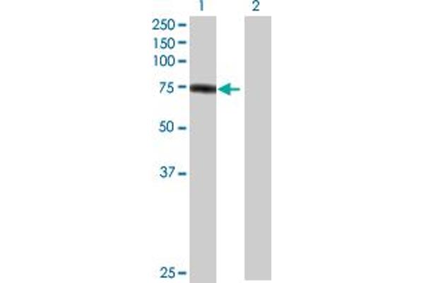 Plakophilin 1 Antikörper  (AA 1-726)
