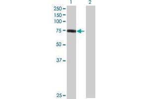 Western Blot analysis of PKP1 expression in transfected 293T cell line by PKP1 MaxPab polyclonal antibody. (Plakophilin 1 Antikörper  (AA 1-726))