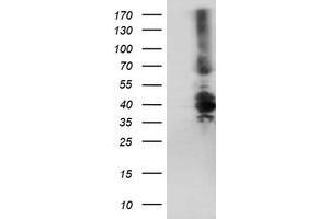 Western Blotting (WB) image for anti-Dystrobrevin, beta (DTNB) antibody (ABIN1497915) (Dystrobrevin beta Antikörper)