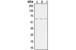 Western blot analysis of AGBL4 expression in HepG2 (A), Jurkat (B), HeLa (C) whole cell lysates. (AGBL4 Antikörper  (C-Term))