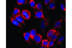 Immunocytochemistry staining of vesicles (red) in RBL-2H3 rat basophilic leukemia cell line using anti-Kinesin (KN-02). (Kinesin (heavy chain) Antikörper)