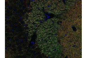 Indirect immunostaining of PFA fixed paraffin embedded mouse hippocampus section with anti-Piccolo (dilution 1 : 500; green) and rabbit anti-Homer 1 (, dilution 1 : 500; red). (Piccolo Antikörper  (Center))
