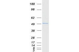 Western Blotting (WB) image for TNFAIP3 Interacting Protein 2 (TNIP2) protein (Myc-DYKDDDDK Tag) (ABIN2733966)
