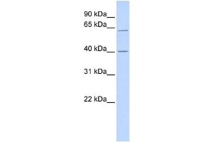 WB Suggested Anti-TRIT1 Antibody Titration:  0. (TRIT1 Antikörper  (Middle Region))