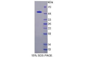 SDS-PAGE analysis of Cow CSN3 Protein.