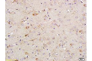 Formalin-fixed and paraffin embedded rat brain tissue labeled with Anti Phospho-TrkA (Tyr674/675) /TrkB (Tyr706/707) Polyclonal Antibody, Unconjugated (ABIN746618) at 1:200 followed by conjugation to the secondary antibody and DAB staining. (TRKA Antikörper  (pTyr680, pTyr681))
